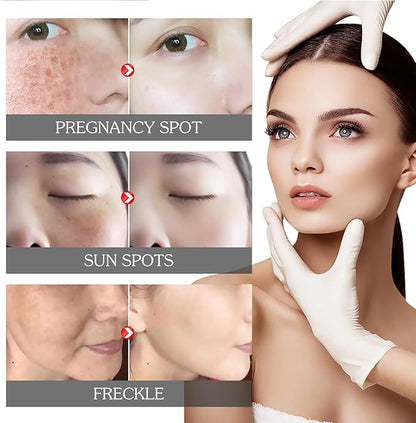 Eelhoe - Pigment Correcting Cream (Original)